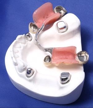 China_Telescopic_crown20098151137344